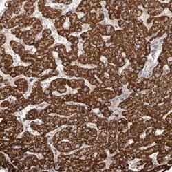 WDR91 Antibody, Novus Biologicals 25 &mu;L | Buy Online | Novus Biologicals | Fisher Scientific